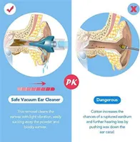 KRY Ear Wax Removal Vacuum for Kids & Adults, Ear Cleaning Kit Smart Earwax Remover Tool with Replaceable Tips, Soft Earwax Cleaner Ear-Pick Clean Set — фото 2