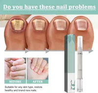 Nail Growth Serum & Treatment Pen - Cuticle Oil, Nourishes Nails & Repairs Foot Care — фото 7