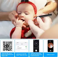 Отоскоп Jkevow 1080P, вушна камера з 6 LED, WiFi, 8 насадок, для чищення вух (iPhone/Android) — фото 3