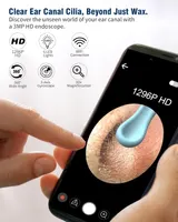 Отоскоп Kekoy 1296P HD (Чорний), вушна камера з 6 LED, WiFi, 8 насадок, для чищення вух (iPhone/Android) — фото 6