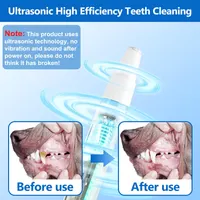 Ni-SHEN Dog Teeth Cleaning Kit, Pet Tooth Cleaner Dental Care Tartar Plaque Remover for Dogs and Cats(White) — фото 6