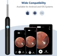 Ear Wax Removal Tool Camera Wireless Ear Cleaner with 6Pcs Ear Picks Rechargeable Ear Cleaner Ear Cleaning Kit for Android and iOS (Black) — фото 7